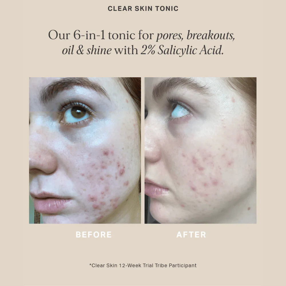 Alpha-H Clear Skin Tonic 100ml - Image 7