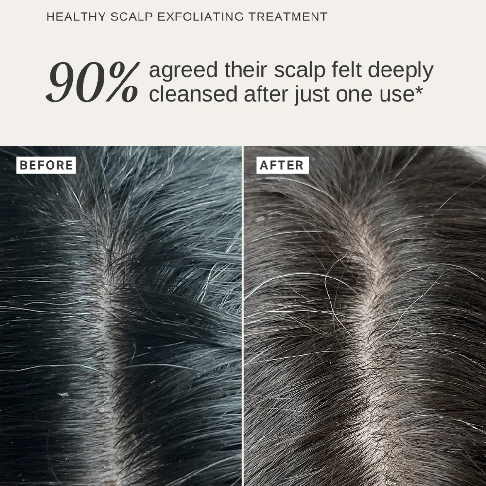Alpha-H Glossy Hair Duo - Image 3