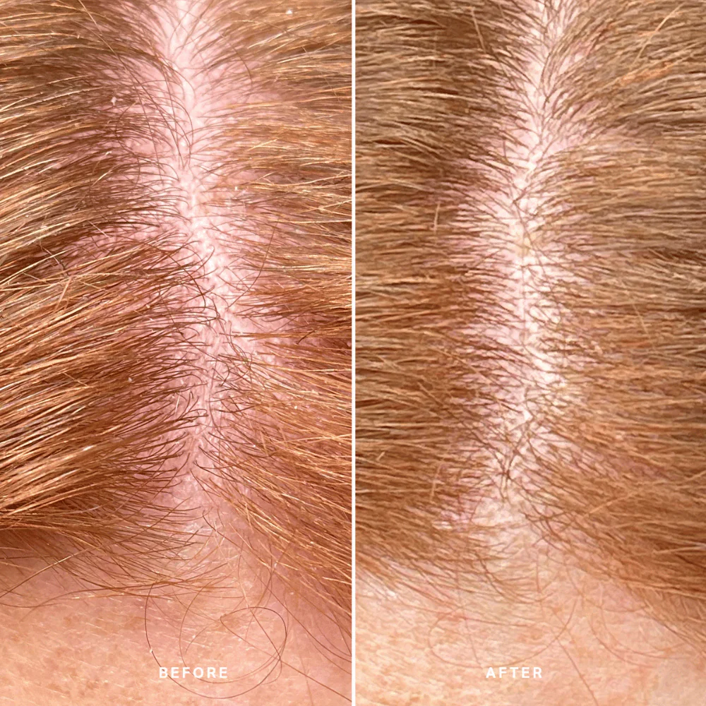 Alpha-H Healthy Scalp Exfoliating Treatment 100ml - Image 7
