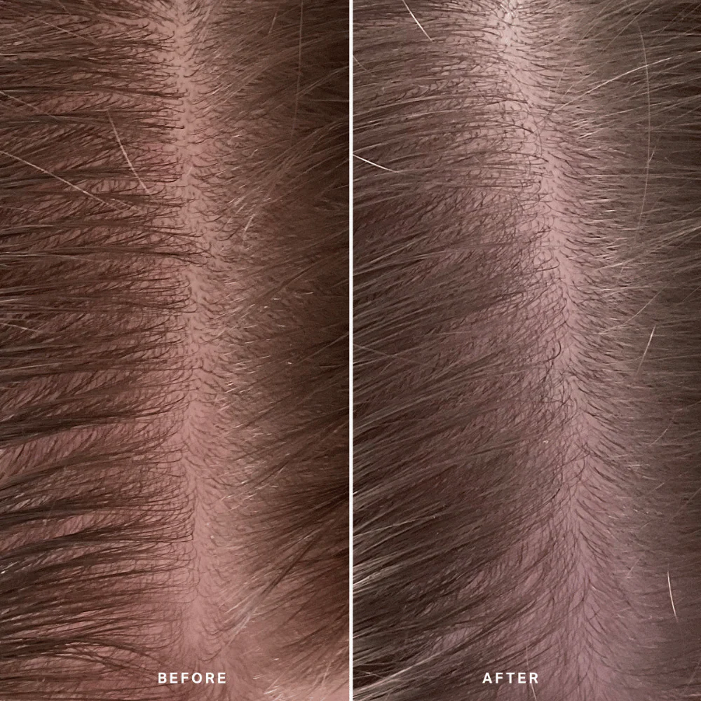 Alpha-H Healthy Scalp Exfoliating Treatment 100ml - Image 8