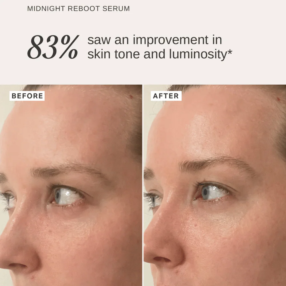 Alpha-H Plump & Firm Duo - Image 5