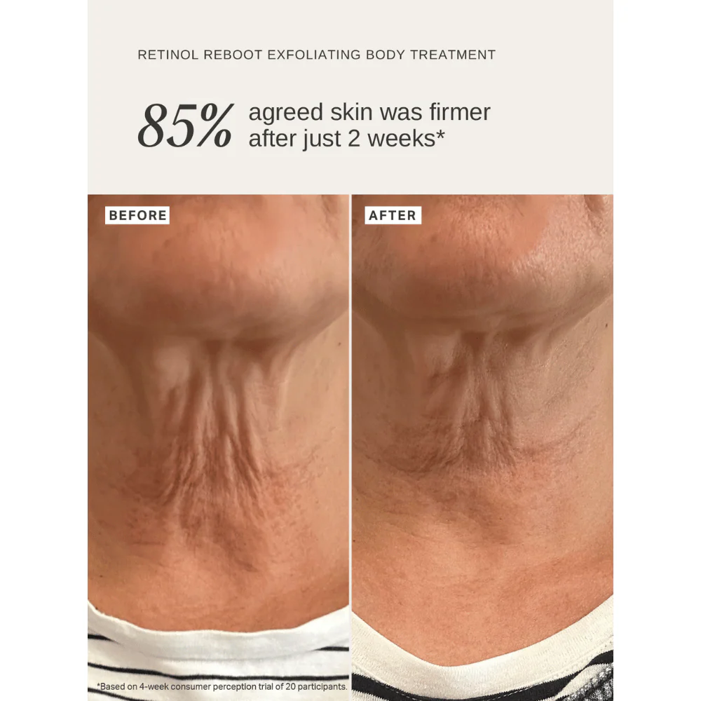 Alpha-H Retinol Reboot Exfoliating Body Treatment 120ml - Image 10