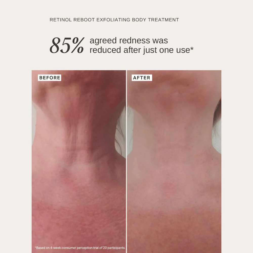 Alpha-H Retinol Reboot Exfoliating Body Treatment 120ml - Image 9