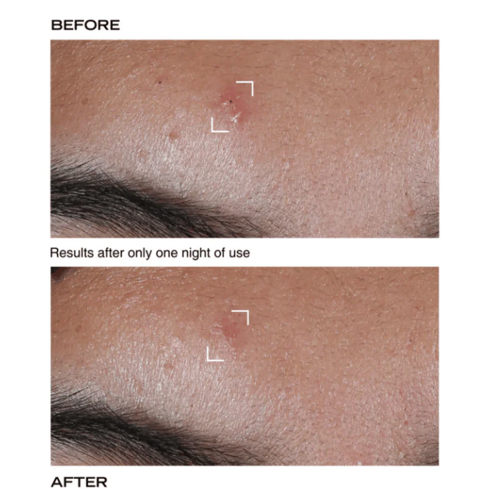 PAYOT Pate Grise Stop Pimple Original Paste 15ml - Image 3