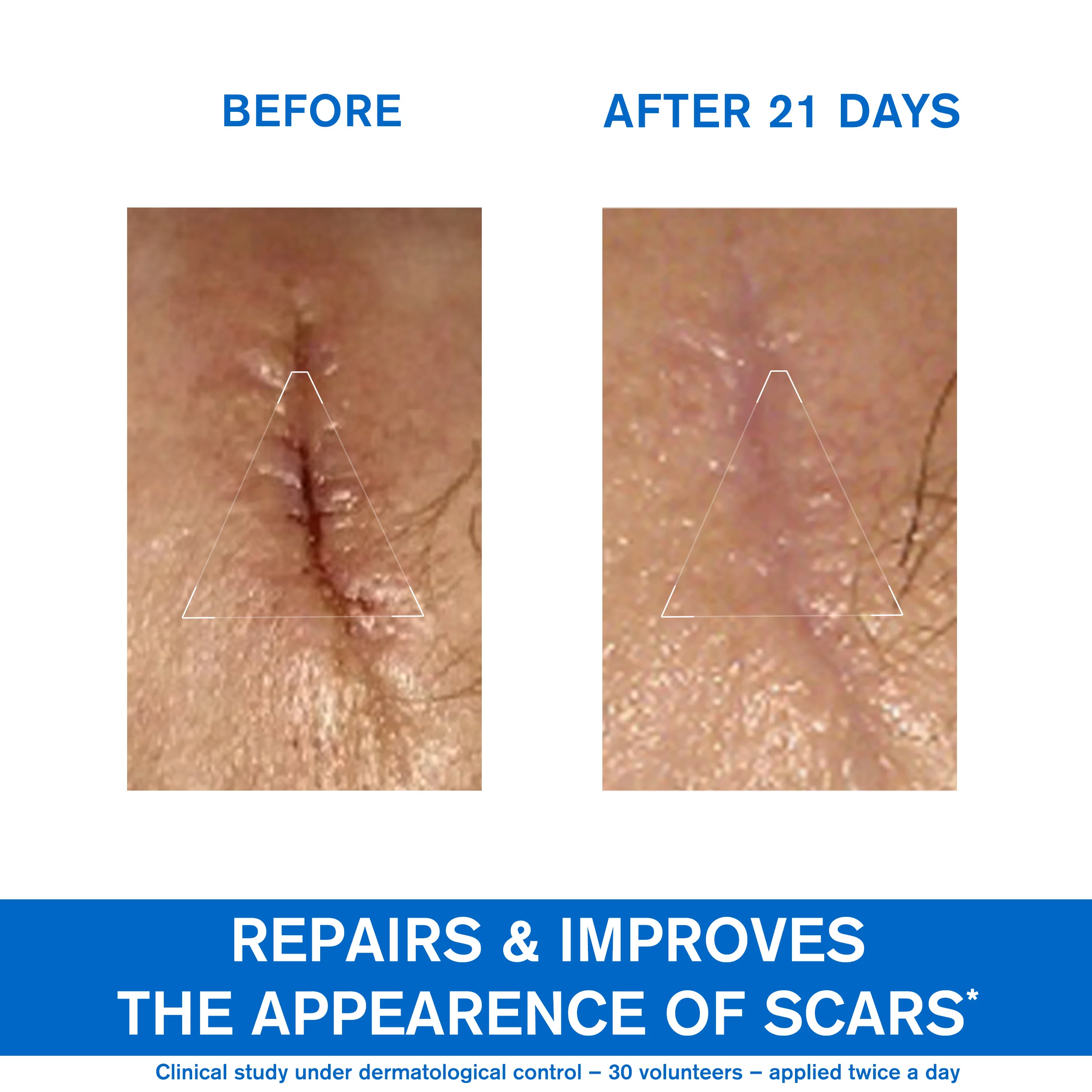 Uriage Bariederm Repairing Cica Cream, Copper And Zinc 40ml - Image 7