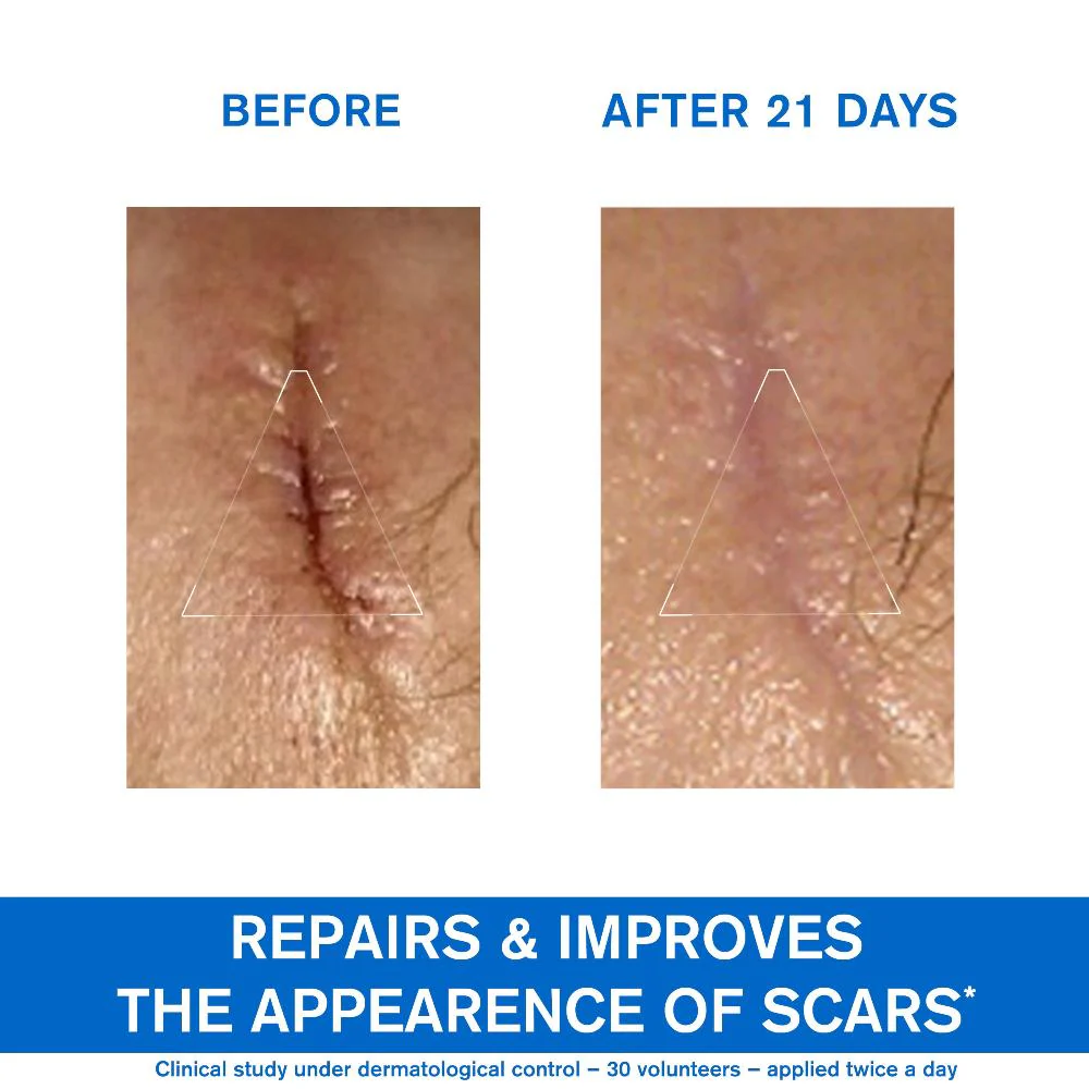 Uriage Bariederm Repairing Cica-Cream 100ml - Image 4