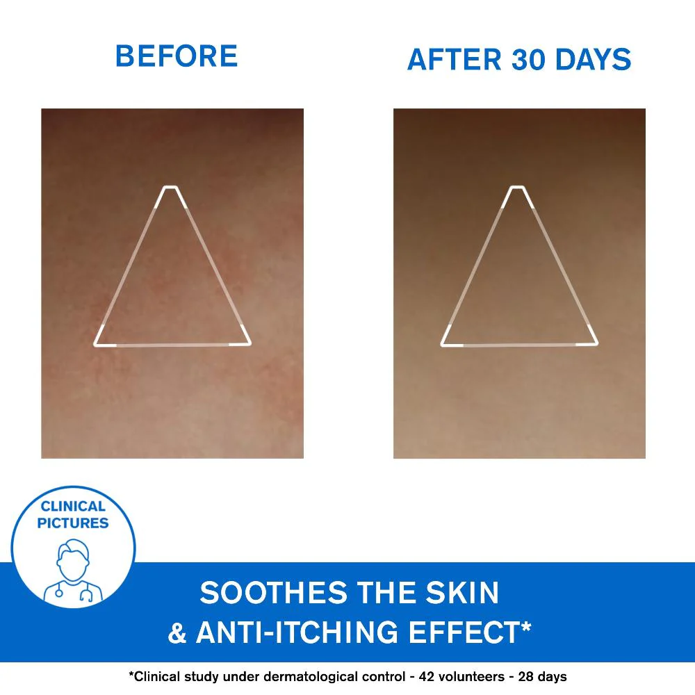 URIAGE XÉMOSE  Lipid-Replenishing Anti Irritation Cerat 200ml - Image 5